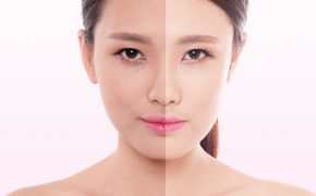 7 cách làm trắng da tự nhiên siêu tốc chị em có thể làm tại nhà