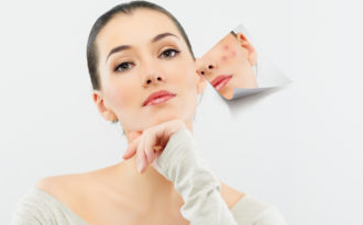 7 cách trị thâm mụn hiệu quả trả lại cho bạn làn da trắng mịn