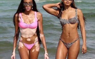 Winnie Harlow khoe dáng săn chắc và thanh mảnh