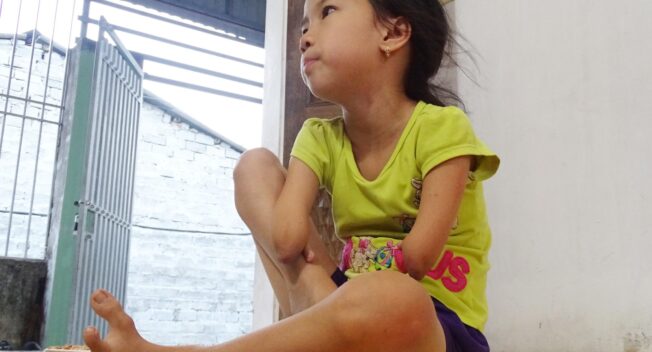 Cô bé 9 tuổi cụt hai tay, viết chữ đẹp như máy khiến bao người cảm phục