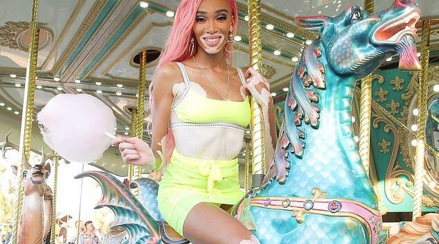 Siêu mẫu bạch biến bốc lửa với váy vàng chanh