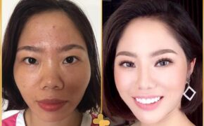 Điểm mặt những gương mặt gây bão mạng sau khi phẫu thuật