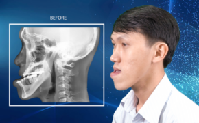 Bức tâm thư đẫm nước mắt và điều kì diệu dành cho Thạc sĩ xe ôm