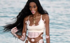 Winnie Harlow sexy với bikini