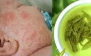 Trị rôm sảy cho trẻ bằng trà xanh rất công hiệu