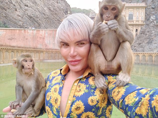  Rodrigo Alves tiết lộ anh vẫn chưa cảm thấy hình ảnh của mình thật sự đẹp hoàn hảo nên sẽ thực hiện thêm ca phẫu thuật thẩm mỹ cắt bớt xương sườn vào đầu tháng 1 năm sau. 