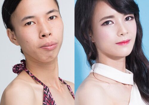 Những cô gái Việt “lột xác” ngoạn mục nhờ dao kéo