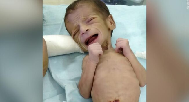 Bé gái 4 ngày tuổi sống sót kỳ diệu sau khi bị chôn sống