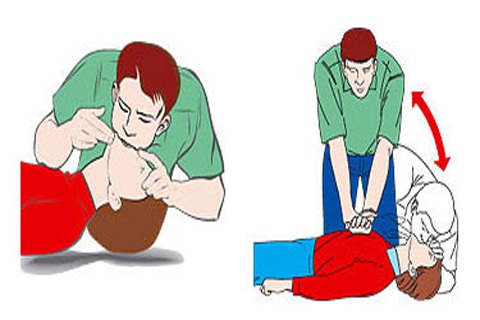Cách nhanh nhất để cứu người bị điện giật - 1 Cách nhanh nhất để cứu người bị điện giật - 1