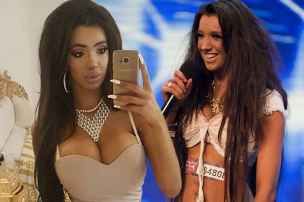  Chloe Khan thay đổi đáng kính ngạc sau những ca đại phẫu thuật thẩm mỹ như bơm môi, nâng mũi, tiêm filler trên mặt, bơm ngực, cắt mỡ toàn thân và nâng cấp vòng ba. 