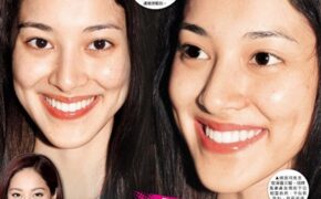 Bằng chứng dao kéo thẩm mỹ của đương kim hoa hậu Hồng Kông