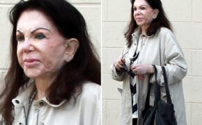 Nữ diễn viên 92 tuổi mặt méo xệch vì phẫu thuật thẩm mỹ