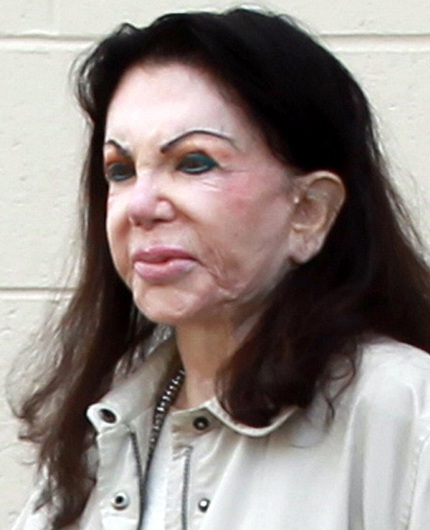 Jackie Stallone với gương mặt méo xệch vì phẫu thuật thẩm mỹ