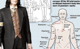 Tìm thấy 38 vết kim tiêm trên thi thể Michael Jackson