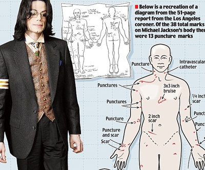 Tìm thấy 38 vết kim tiêm trên thi thể Michael Jackson