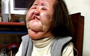 “Thảm hoạ thẩm mỹ xứ Hàn” qua đời ở tuổi 57