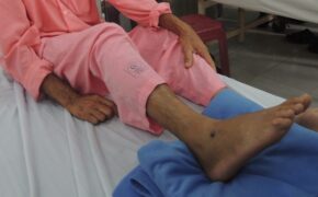 Nhiều sai lầm khi xử lý rắn cắn