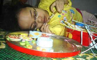 Cô gái xương thủy tinh “gieo” hi vọng cho người khuyết tật