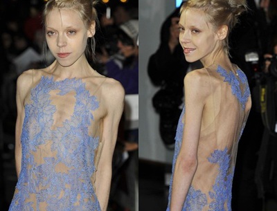 Sốc với thân hình xương xẩu của nữ diễn viên Ai len