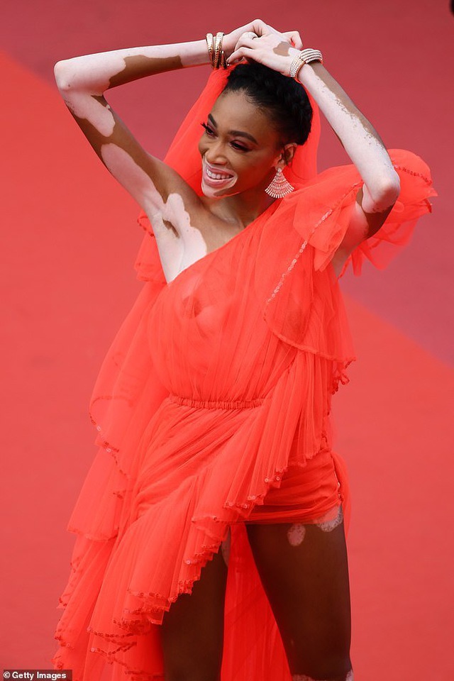 Winnie Harlow gặp sự cố trên thảm đỏ Cannes vì váy quá ngắn - 9