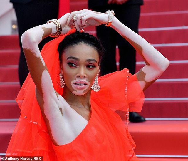 Winnie Harlow gặp sự cố trên thảm đỏ Cannes vì váy quá ngắn - 3