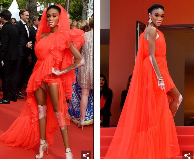 Winnie Harlow gặp sự cố trên thảm đỏ Cannes vì váy quá ngắn - 5