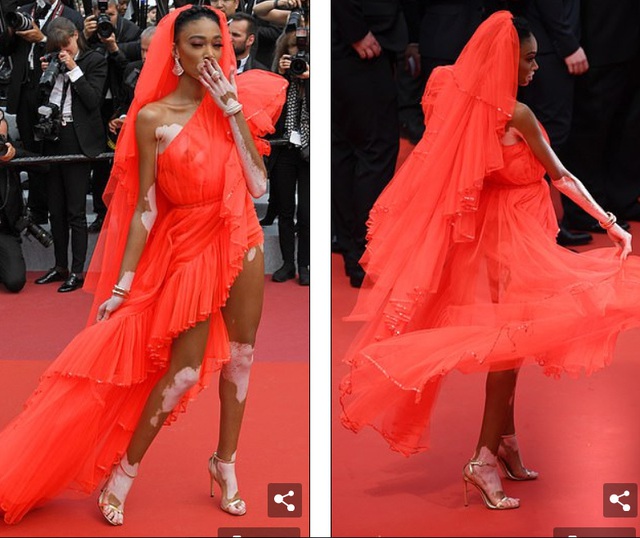 Winnie Harlow gặp sự cố trên thảm đỏ Cannes vì váy quá ngắn - 7