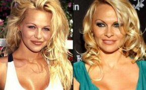 Sao biến đổi thế nào sau phẫu thuật thẩm mỹ?