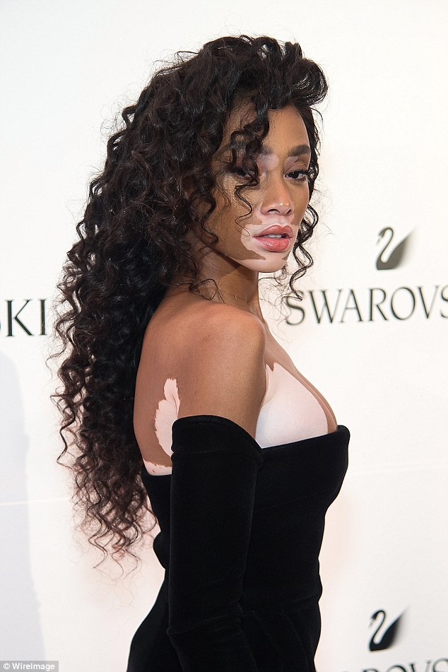  Người mẫu Canada - Winnie Harlow xuất hiện nổi bật trong bữa tiệc do Swarovski tổ chức tại New York ngày 25/5 vừa qua 