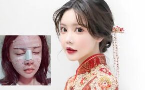 Cô gái Trung Quốc 20 tuổi phẫu thuật thẩm mỹ tổng cộng 33 lần