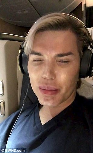  Rodrigo Alves bật khóc khi đáp chuyến bay từ Ấn Độ về Anh quốc sau khi bác sỹ tuyên bố nhãn cầu của anh quá nhỏ, quá nguy hiểm để thay màu mắt và từ chối thực hiện ca phẫu thuật cho anh này 