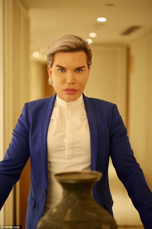  Rodrigo Alves tiết lộ anh ghét màu mắt của mình, bạn bè của anh đã tới Ấn Độ phẫu thuật đổi màu mắt rất nhiều và đều đẹp, vì thế anh chàng cũng tới đây với mong muốn có màu mắt mới 