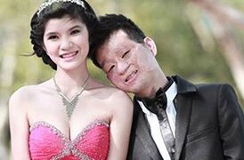 Chuyện tình đáng ngưỡng mộ “chồng xấu – vợ xinh” gây sốt trên mạng