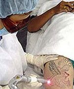 “Trút bỏ” của độc trên người