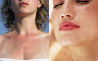 5 giải pháp cho làn da mùa nắng ‘thiêu đốt’