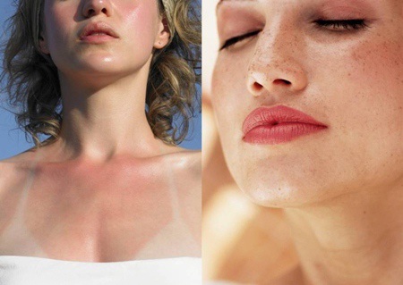 5 giải pháp cho làn da mùa nắng ‘thiêu đốt’