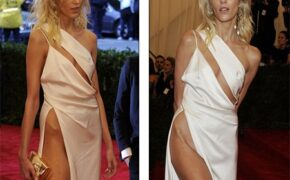 Diện váy xẻ cao, siêu mẫu gây sốc với chân gầy guộc