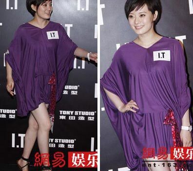 “Bà bầu” Tôn Lệ khoe chân