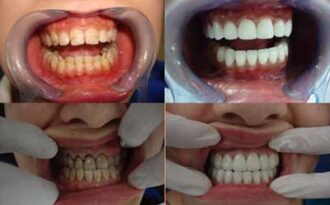 TT Nha khoa Úc Châu – Giải pháp cho hàm răng khỏe đẹp