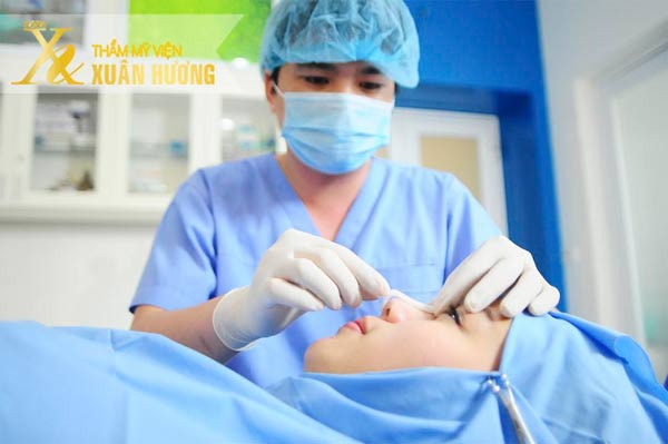 Nâng mũi S line cho dáng mũi cong chữ S mềm mại và đẹp hoàn hảo