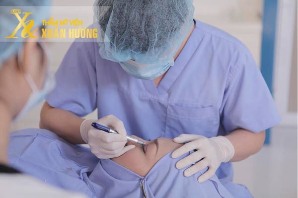 Đôi mắt hai mí đẹp lung linh với dịch vụ bấm mí Hàn Quốc