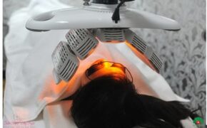 Cơ hội trị mụn miễn phí bằng công nghệ mới Healite tại Thẩm mỹ Hồng Ngọc