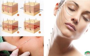 Nâng cơ mặt bằng chỉ với chuyên gia Hàn Quốc