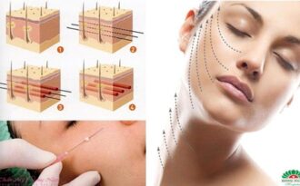 Nâng cơ mặt bằng chỉ với chuyên gia Hàn Quốc