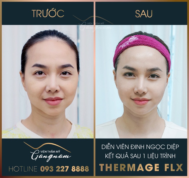 Những sao nữ xuyên không về thanh xuân chỉ sau 1 thời gian ngắn - 5