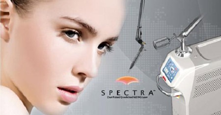 Điều trị nám da bằng công nghệ Spectra Nrd Yag Laser