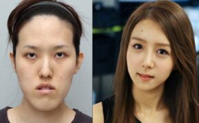 Địa chỉ thẩm mỹ viện uy tín tại Việt Nam