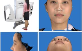 Nâng mũi 3D tại Thẩm mỹ Hàn Quốc Dr Nam