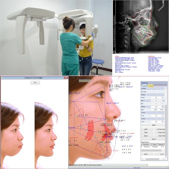 Quá trình chăm sóc sau phẫu thuật cũng là vấn đề