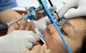 Phẫu thuật hàm hô móm (vẩu)